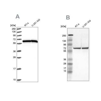 Western Blot: HSP60 Antibody [NBP2-55503]