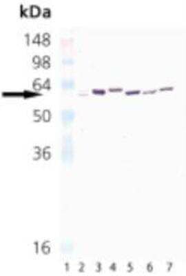 Western Blot: HSP65 (mycobacterial) Antibody (3F7) [NBP1-97880]