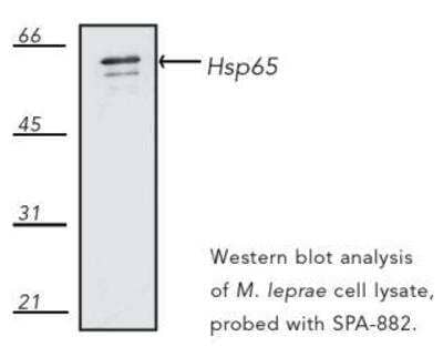 Western Blot: HSP65 (mycobacterial) Antibody (4H11) [NBP1-97874]