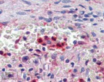 Immunohistochemistry-Paraffin: HSP70/HSPA1A Antibody [NBP1-97872]
