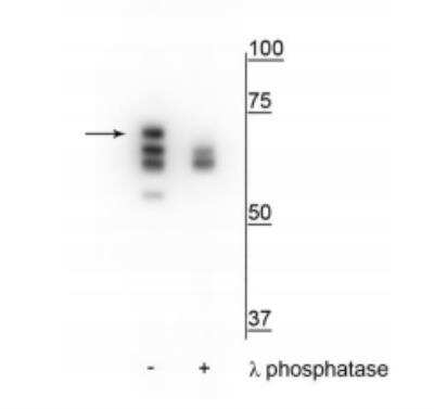 Western Blot: HSP70/HSPA1A [p Ser153] Antibody [NBP2-60773]