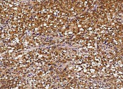 Immunohistochemistry-Paraffin: HSP70/HSPA1A Antibody (001) [NBP2-89951]