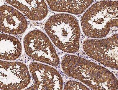 Immunohistochemistry-Paraffin: HSP70/HSPA1A Antibody (001) [NBP2-89951]