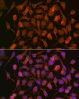 Immunocytochemistry/ Immunofluorescence: HSP70/HSPA1A Antibody (5U9A0) [NBP3-16482]