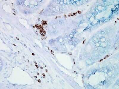 Immunohistochemistry: HSP70/HSPA1A Antibody (BB70) [NB110-96427]