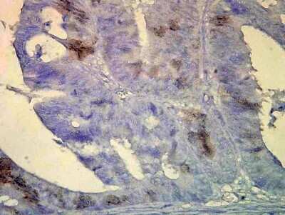 Immunohistochemistry: HSP70/HSPA1A Antibody (BB70) [NB110-96427]