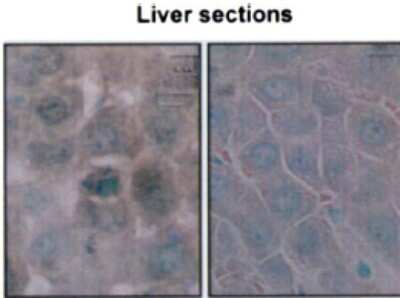 Immunohistochemistry-Paraffin: HSP70/HSPA1A Antibody (BB70) [NB110-96427]