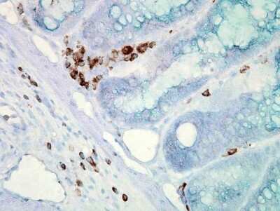 Immunohistochemistry: HSP70/HSPA1A Antibody (C92F3A-5) [NB110-61582]