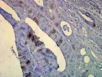 Immunohistochemistry: HSP70/HSPA1A Antibody (C92F3A-5) [NB110-61582]
