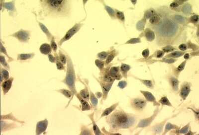 Immunohistochemistry-Paraffin: HSP70/HSPA1A Antibody (C92F3A-5) [NB110-61582]