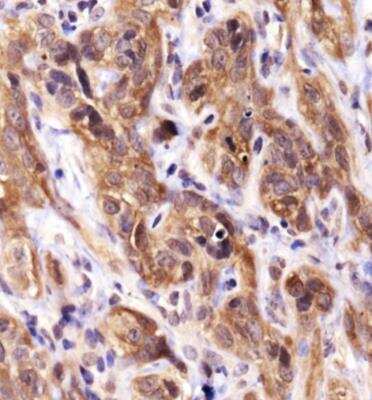 Immunohistochemistry: HSP70/HSPA1A Antibody - BSA Free [NBP1-77455]