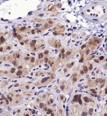 Immunohistochemistry: HSP70/HSPA1A Antibody - BSA Free [NBP1-77456]