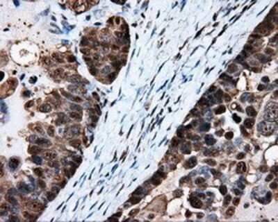 Immunohistochemistry: HSP70/HSPA1A Antibody (OTI3G9) - Azide and BSA Free [NBP2-70954]