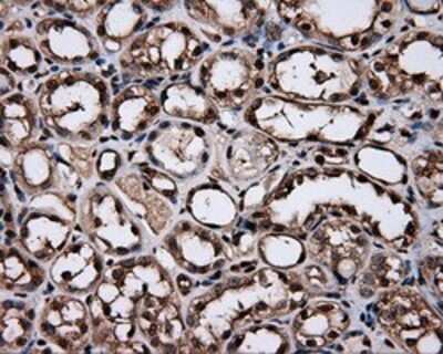 Immunohistochemistry: HSP70/HSPA1A Antibody (OTI3G9) - Azide and BSA Free [NBP2-70954]