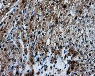 Immunohistochemistry: HSP70/HSPA1A Antibody (OTI3G9) - Azide and BSA Free [NBP2-70954]