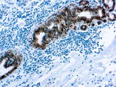 Immunohistochemistry-Paraffin: HSP70/HSPA1A Antibody (W27) [NBP2-26422]