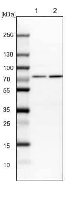 Western Blot: HSP70/HSPA1A Antibody [NBP2-46806]