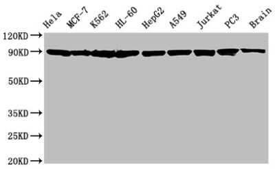 Western Blot: HSP90 Antibody (10D6) [NBP3-15144]