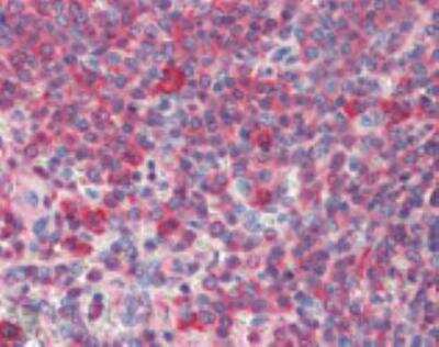Immunohistochemistry-Paraffin: HSP90 Antibody (16F1) [NBP1-97506]