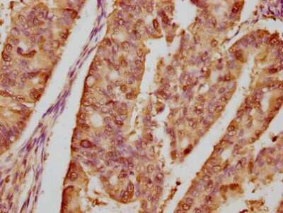 Immunohistochemistry: HSP90 Antibody (4B5) [NBP3-15145]