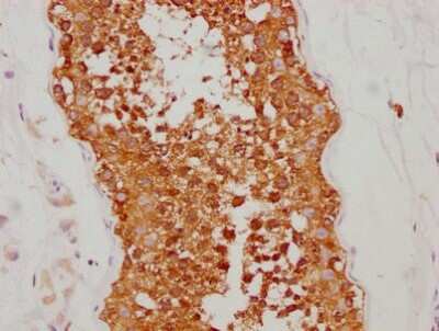 Immunohistochemistry: HSP90 Antibody (4D1) [NBP3-15147]
