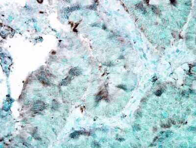 Immunohistochemistry: HSP90 Antibody (4F3.E8) [NBP2-12878]