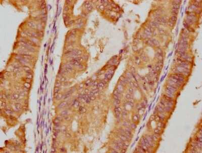 Immunohistochemistry: HSP90 Antibody (4F8) [NBP3-15146]