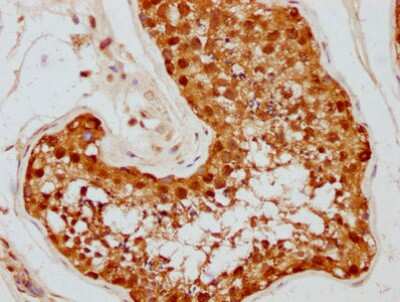 Immunohistochemistry: HSP90 Antibody (4F8) [NBP3-15146]