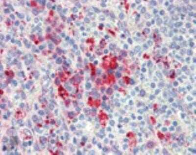 Immunohistochemistry: HSP90 Antibody (AC88) [NB100-1972]