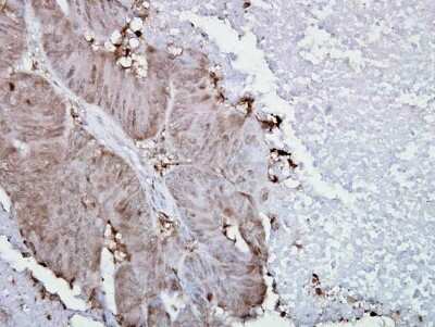 Immunohistochemistry: HSP90 alpha Antibody (Hyb-K41009) [NB110-61641]