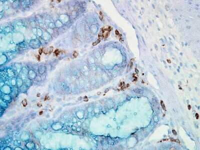 Immunohistochemistry: HSP90 alpha Antibody (Hyb-K41009) [NB110-61641]