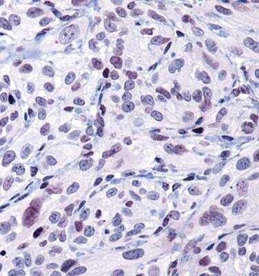 Immunohistochemistry: HSP90 alpha Antibody - BSA Free [NBP1-77682]