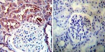 Immunohistochemistry-Paraffin: HSP90 alpha Antibody [NB120-2928]