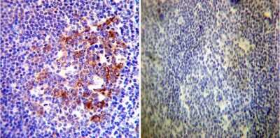 Immunohistochemistry-Paraffin: HSP90 alpha Antibody [NB120-2928]