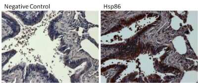 Immunohistochemistry-Paraffin: HSP90 alpha Antibody [NB120-2928]