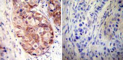 Immunohistochemistry-Paraffin: HSP90 alpha Antibody [NB120-2928]
