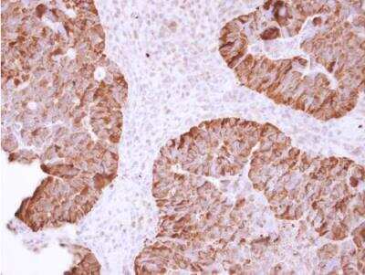 Immunohistochemistry-Paraffin: HSP90 alpha Antibody [NBP2-16895]