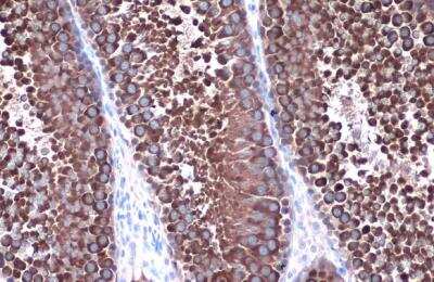 Immunohistochemistry-Paraffin: HSP90 alpha Antibody [NBP2-16895]