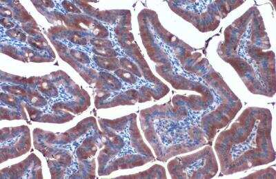 Immunohistochemistry-Paraffin: HSP90 alpha Antibody [NBP2-16895]