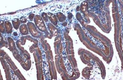 Immunohistochemistry-Paraffin: HSP90 alpha Antibody [NBP2-16895]