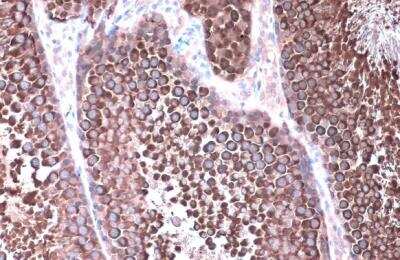 Immunohistochemistry-Paraffin: HSP90 alpha Antibody [NBP2-16895]