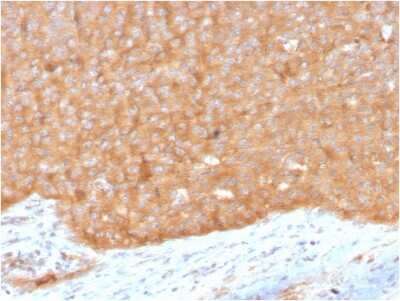 Immunohistochemistry-Paraffin: HSP90 beta Antibody (HSP90AB1/3951) [NBP3-07185]