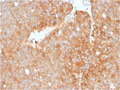 Immunohistochemistry-Paraffin: HSP90 beta Antibody (HSP90AB1/3952) [NBP3-07186]