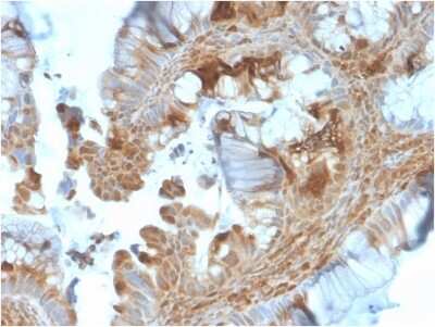 Immunohistochemistry-Paraffin: HSP90 beta Antibody (HSP90AB1/3953) - Azide and BSA Free [NBP3-08908]