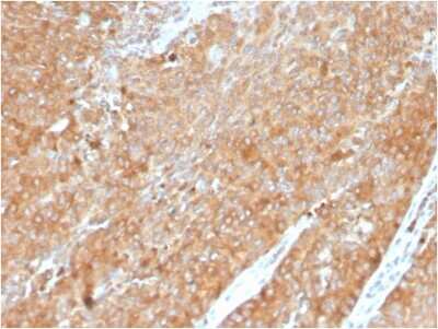 Immunohistochemistry-Paraffin: HSP90 beta Antibody (HSP90AB1/3954) - Azide and BSA Free [NBP3-08937]