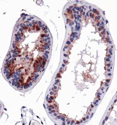 Immunohistochemistry: HSP90 beta Antibody - BSA Free [NBP1-77563]