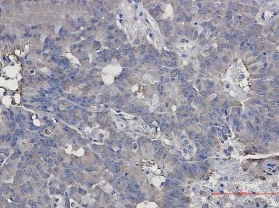 Immunohistochemistry-Paraffin: HSP90 beta Antibody (S03-8F1) [NBP3-19877]