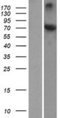 Western Blot: HSPA12A Overexpression Lysate [NBP2-06245]