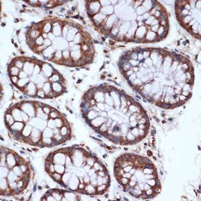 Immunohistochemistry-Paraffin: HSPA14 Antibody (4L1Z6) [NBP3-16107]