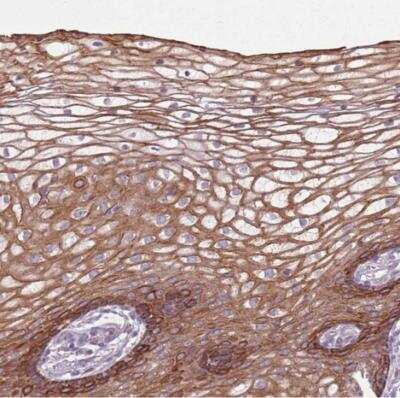 Immunohistochemistry-Paraffin: HSPA14 Antibody [NBP2-14106]